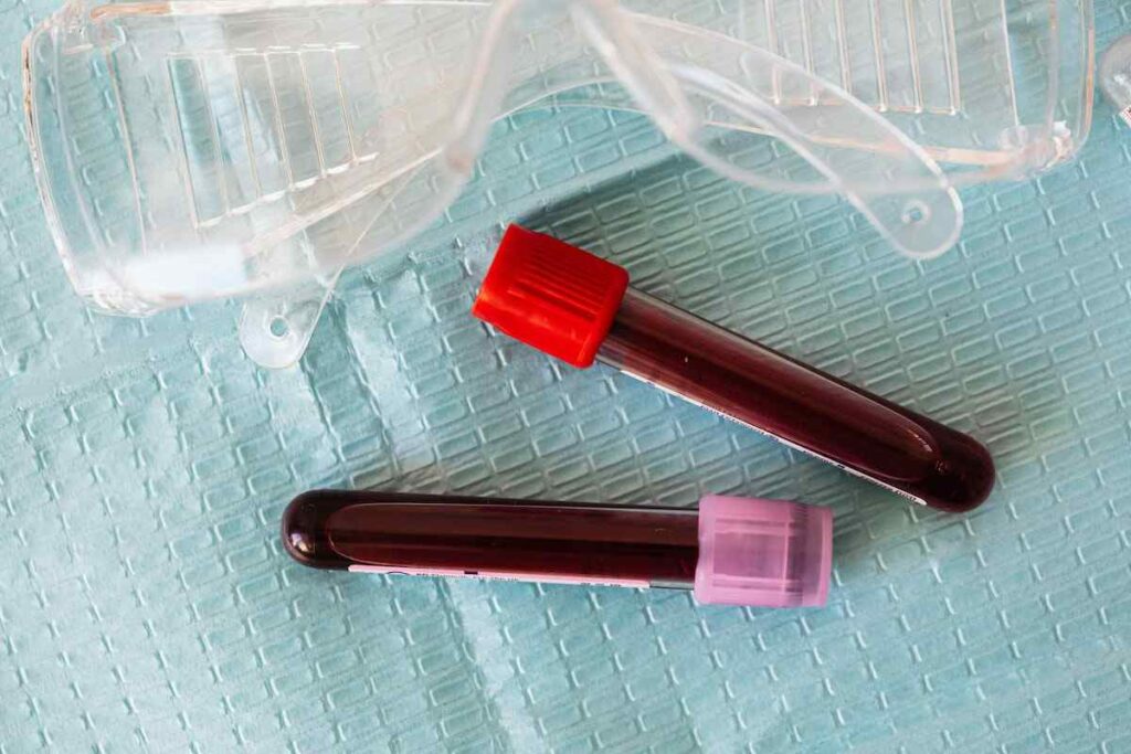 Exame toxicológico